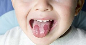 Coğrafik Dil Nedir Tatlı Bir Telaş, Tatlı Bir Telaş, Tatlı Bir Telaş