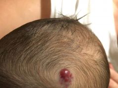 Hemanjiyom Hikayemiz hemanjiyom