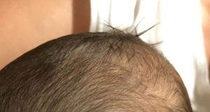 Hemanjiyom Hikayemiz Tatlı Bir Telaş, Tatlı Bir Telaş, Tatlı Bir Telaş